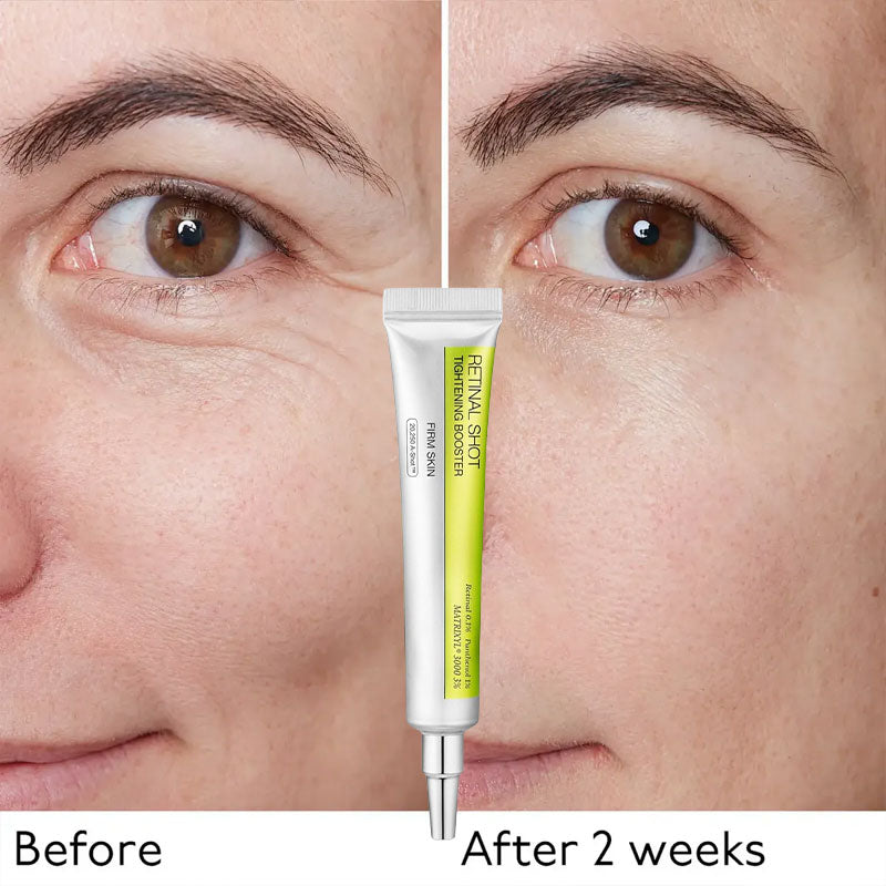 Retinol uppstramande ögonkräm