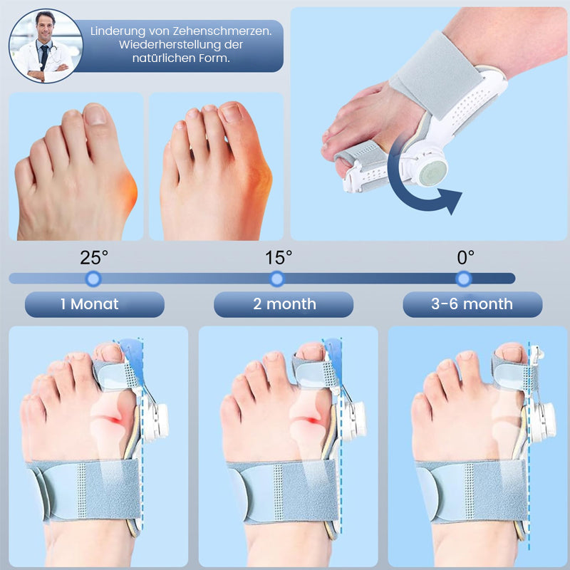 🔥Bunion Corrector for Men and Women (Upgraded Version)