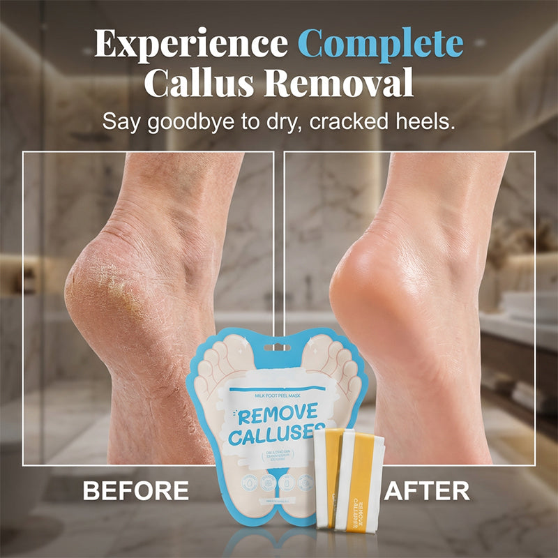 Exfoliating Foot Peel Mask for Callus Removal