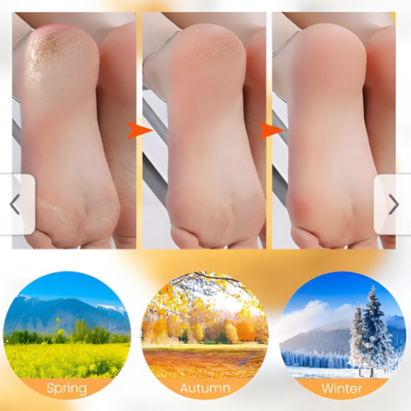 📢📢Buy 1 Get 1 Free🔥Silicone Gel Moisturizing Socks